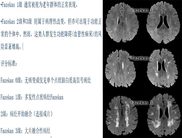 健忘、迷路、认错人,到底是不是“老年痴呆”?做这项检查就能揪出元凶(图7) 买东西算不清账